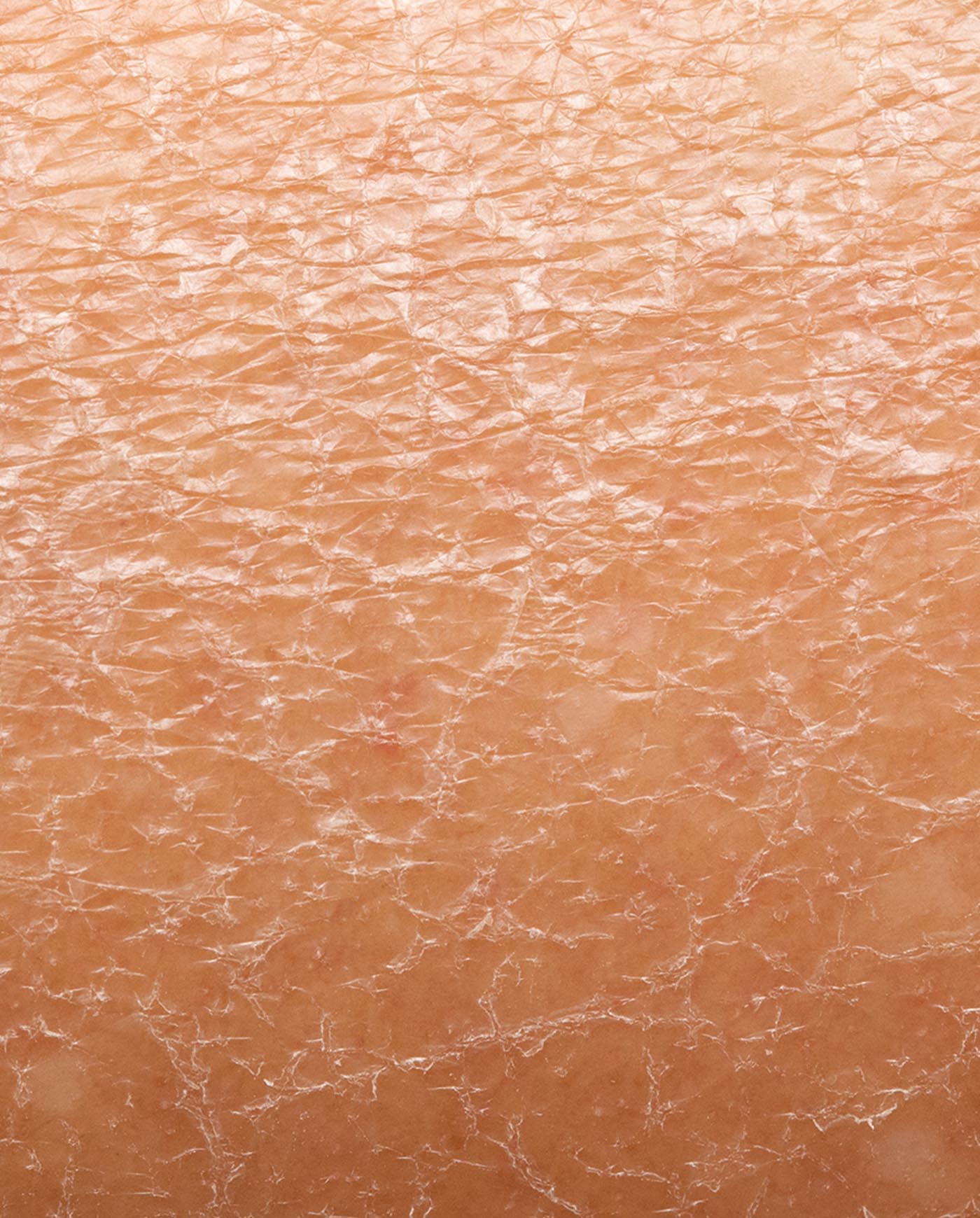 Risultati Mavex Sebo Balance anti-acne