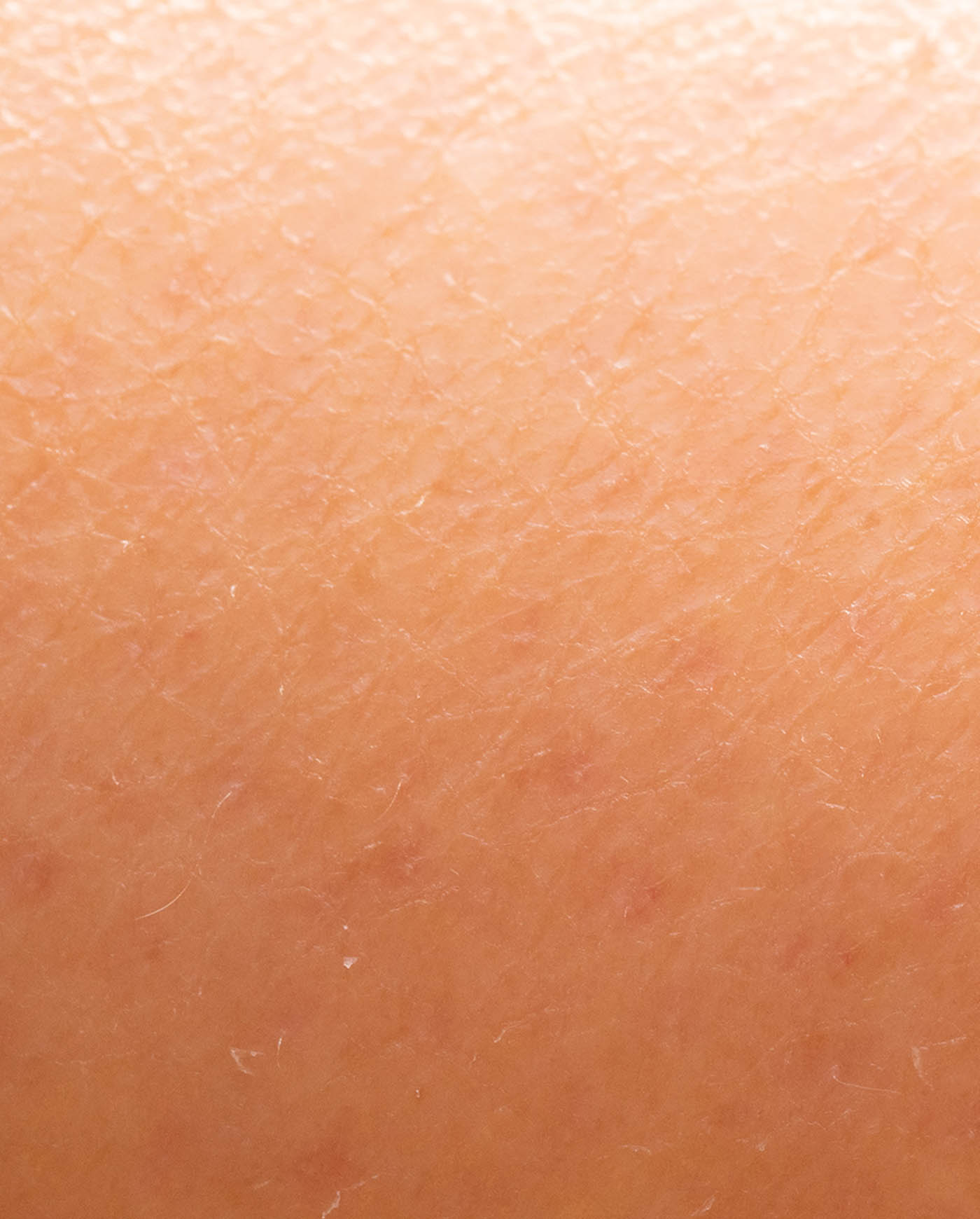 Risultati Mavex Sebo Balance anti-acne